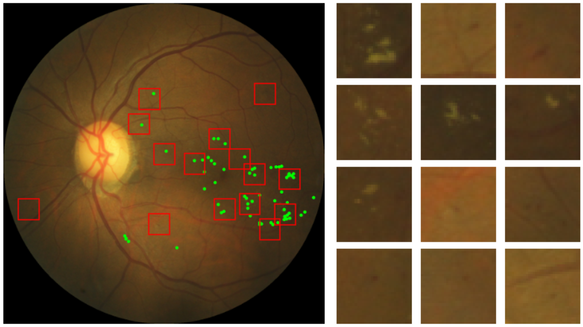 Research area: interpretable ML